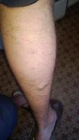 post-3551-0-17969700-1386679382_thumb.jpg